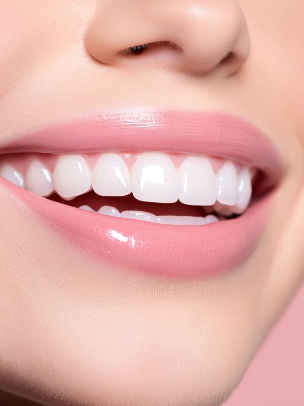 Smile