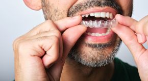 mans lower face while putting in a retainer