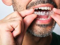 mans lower face while putting in a retainer
