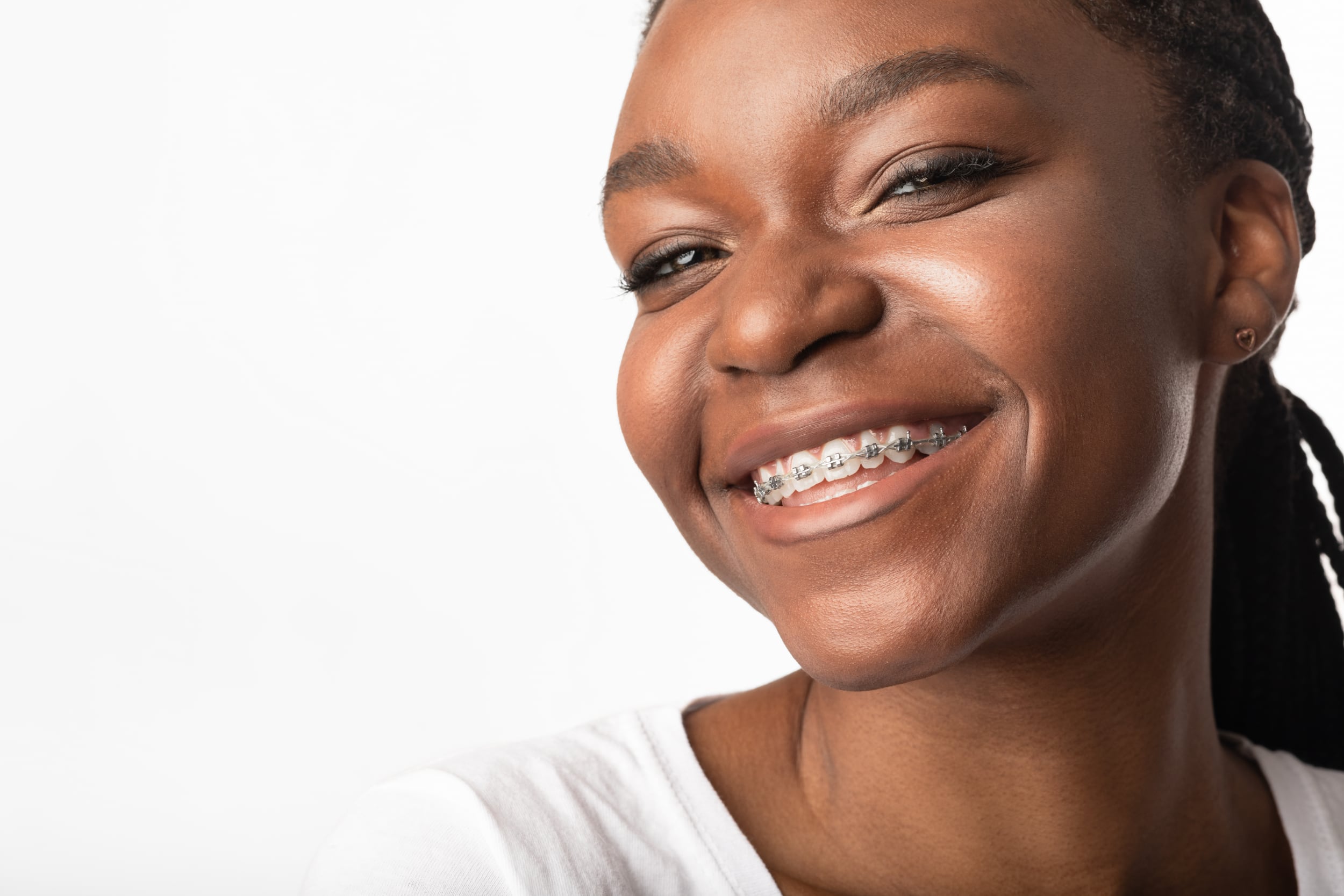 3 Braces Follow Up