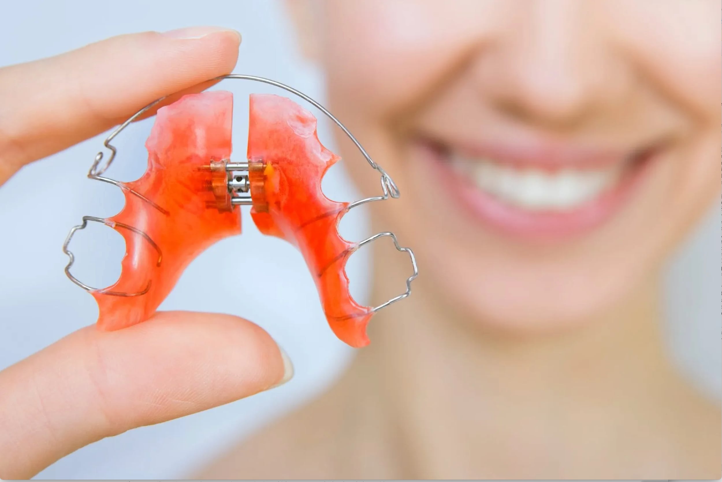 Photo of a removable expander orthodontics braces with a perfect smile in the background.