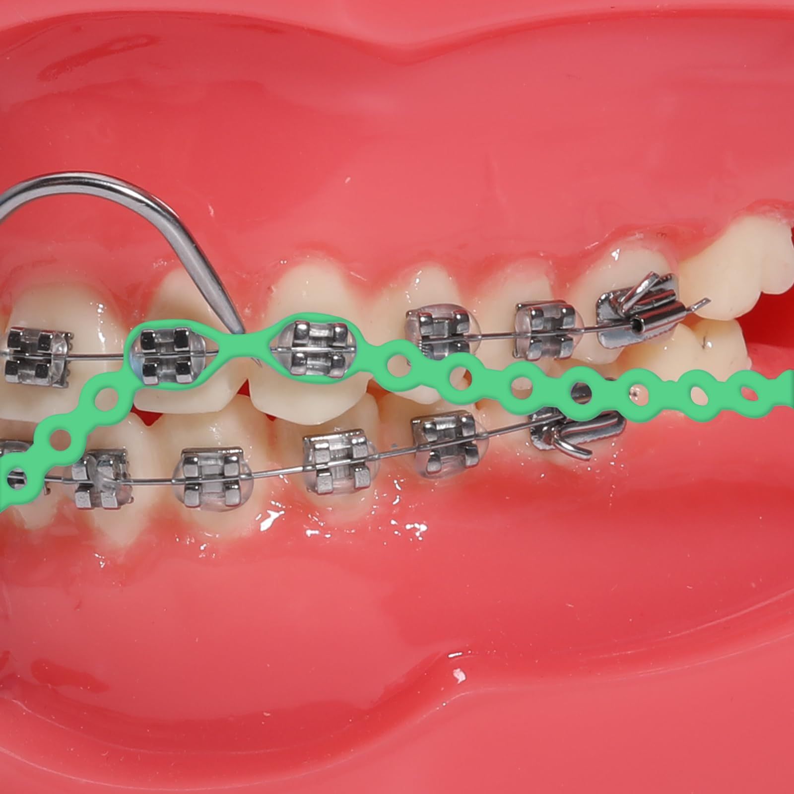 A Green Power Chain going on metal braces